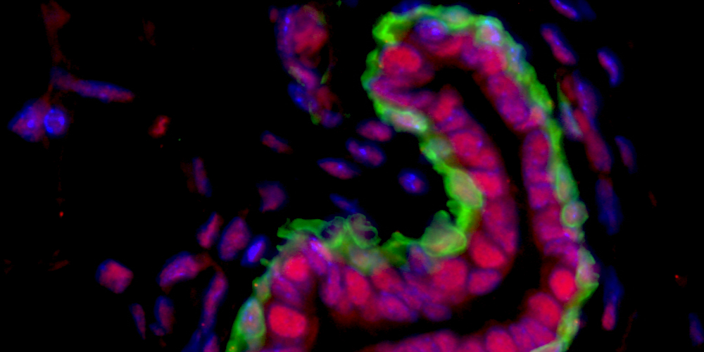 Ruth Keri Lab