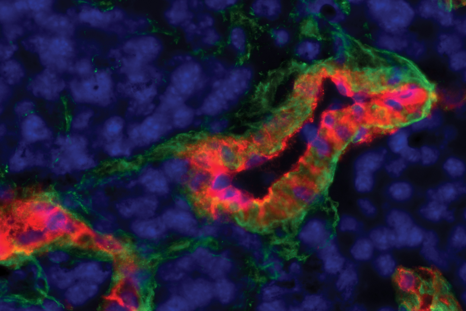 Tatiana Byzova Lab