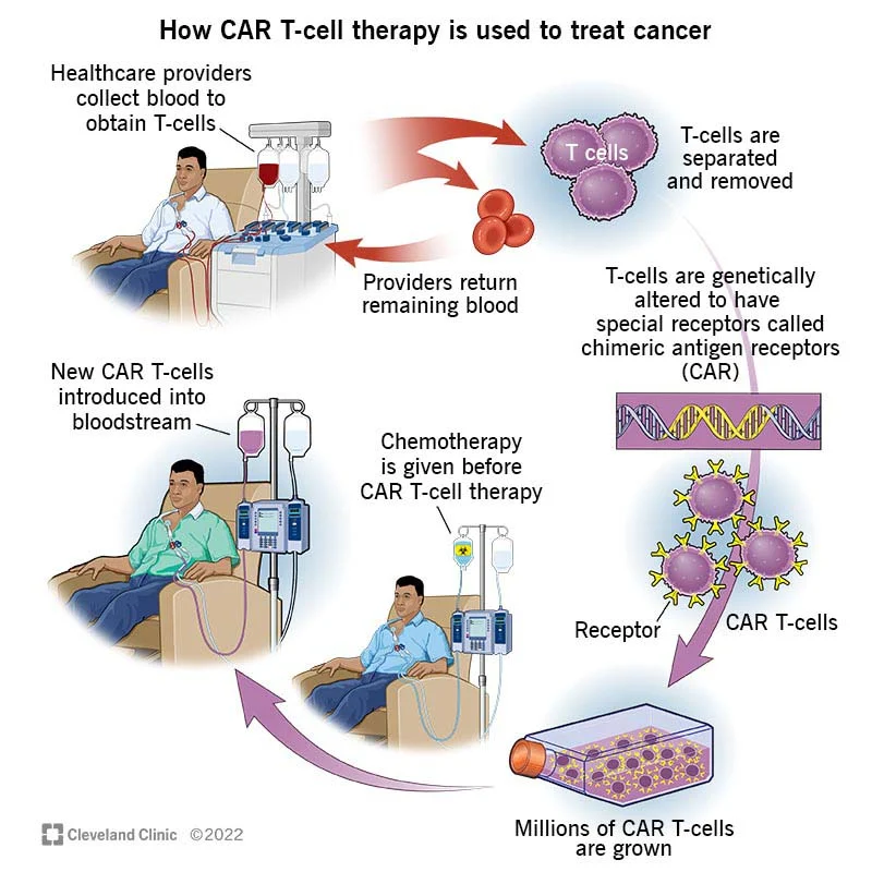 infographic depicting how cell therapy is used to treat cancer