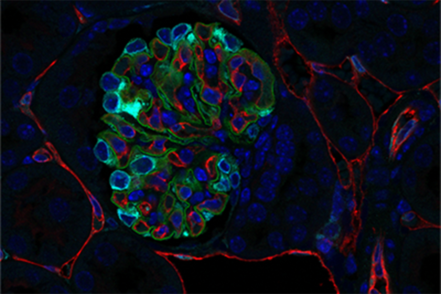 Leslie Bruggeman Lab