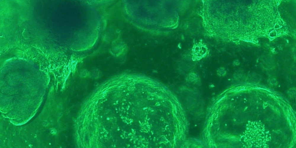 Michelle Longworth Lab