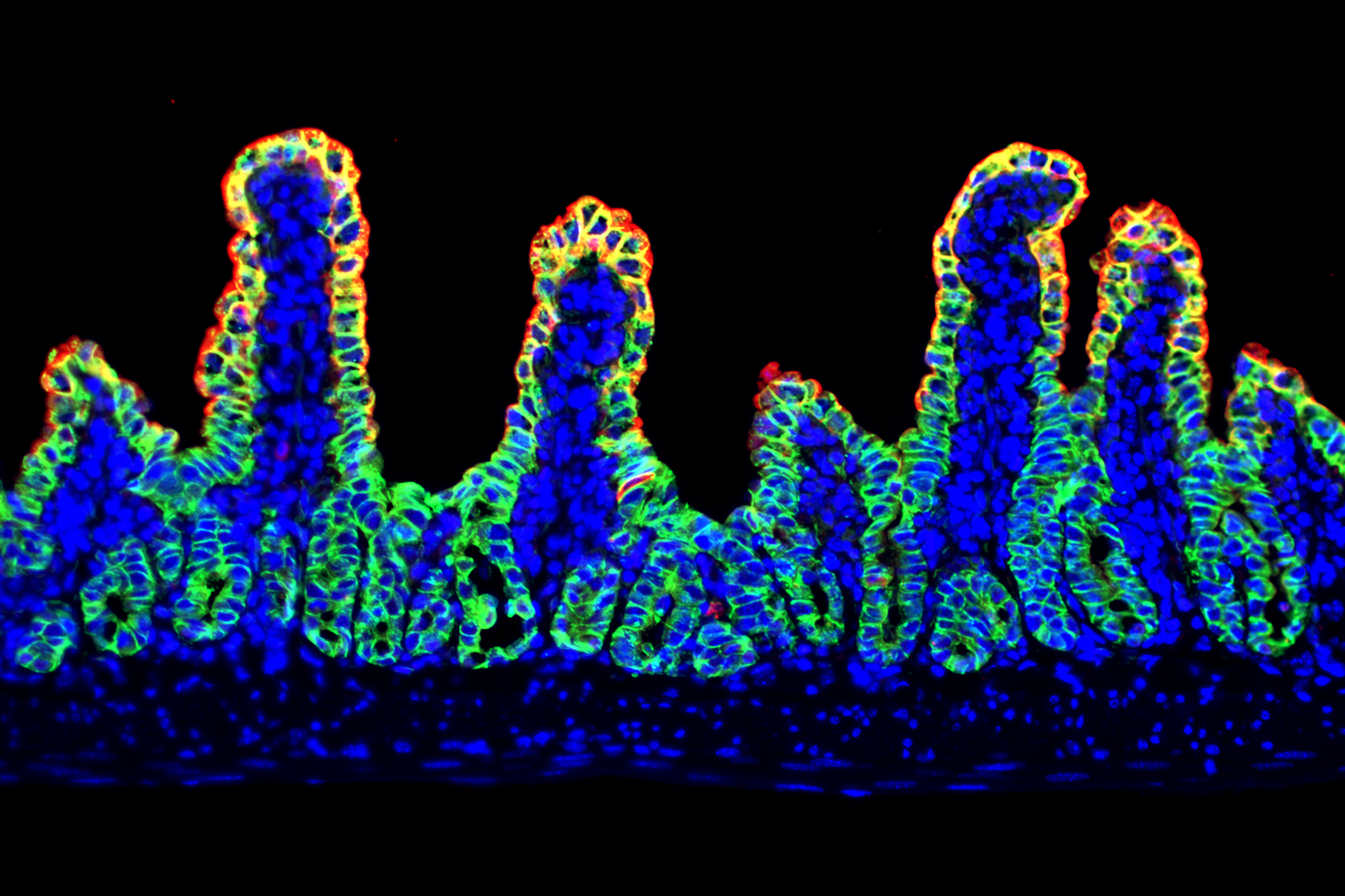 Thaddeus Stappenbeck Lab