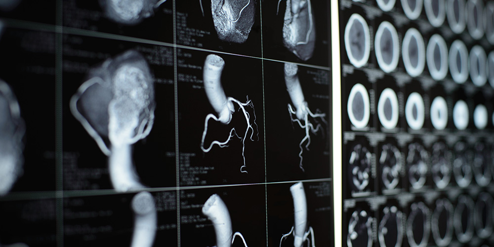 Xuefeng (Chris)  Liu Research Program